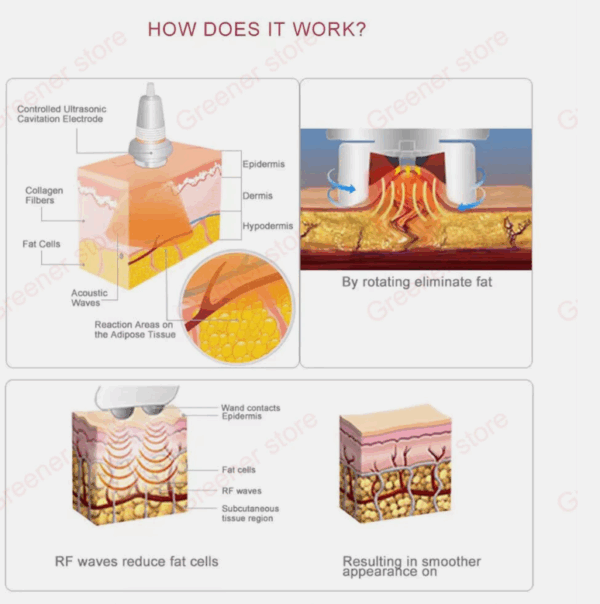 Máquina Cavitación 5 en 1 – Vacío, Láser, Radiofrecuencia y Quemador de Grasa | Profesional Slimming RF 40K - Image 3