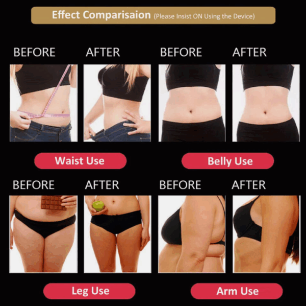 Máquina Cavitación 5 en 1 – Vacío, Láser, Radiofrecuencia y Quemador de Grasa | Profesional Slimming RF 40K - Image 4